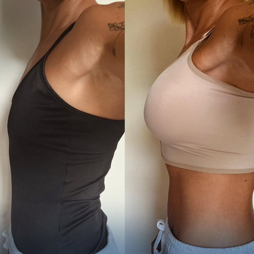 MyCurves - Boob Gummies